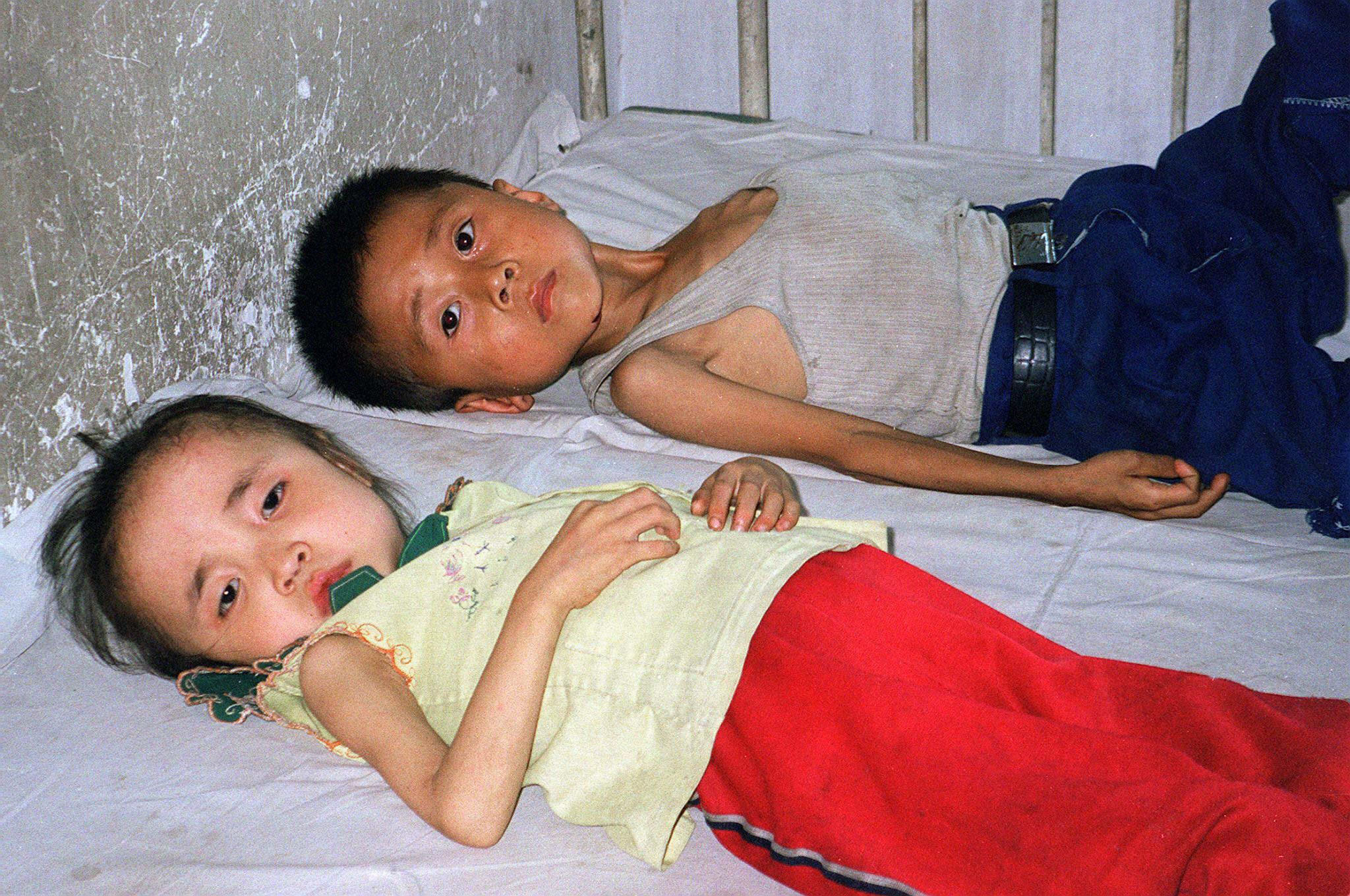 Innumerables niños se quedaron sin comida suficiente para comer en Corea del Norte en la década de 1990